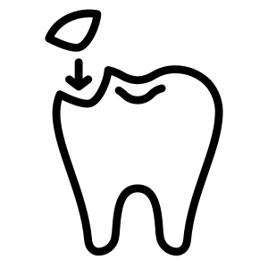 Composite Bonding service image